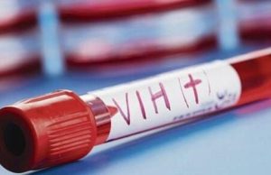 Un trasplante de células madre logra la curación del VIH en el décimo paciente