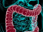 El síntoma que no debería ignorar al ir al baño y que puede revelar cáncer de colon, según gastroenterólogo