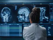 Trivia Maloka | ¿Qué sucede en el cerebro cuando experimentamos un ‘corazón roto’ o rechazo social? Descúbralo aquí