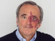 Academia de Ciencias de EE.UU. retira artículo sobre avances contra el cáncer de páncreas por conflicto de intereses de sus autores