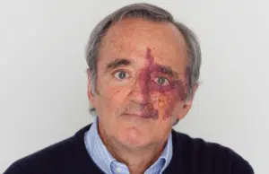 Academia de Ciencias de EE.UU. retira artículo sobre avances contra el cáncer de páncreas por conflicto de intereses de sus autores