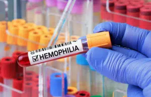 Solo 6 de cada 10 pacientes con hemofilia reciben atención integral en Colombia: diagnóstico temprano es clave para mejorar vida de quienes la padecen