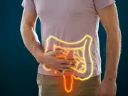 Aumento de muertes por cáncer colorrectal en jóvenes se concentra en personas con menor educación, dice estudio de JAMA Oncology