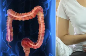 Expertos aclaran los riesgos del consumo excesivo de ultraprocesados: ¿pueden causar cáncer?