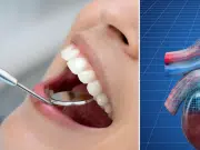 La salud dental podría afectar los riñones: descubren vínculo inesperado entre dientes y enfermedad renal crónica