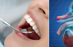 La salud dental podría afectar los riñones: descubren vínculo inesperado entre dientes y enfermedad renal crónica