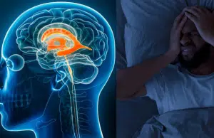 El dolor de cabeza que desaparece al acostarse: una señal temprana de hipotensión intracraneal, patología que puede deteriorar la calidad de vida