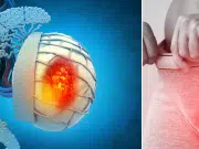 Cáncer testicular: los cuatro síntomas del ‘bulto silencioso’ que más afectan a hombres jóvenes