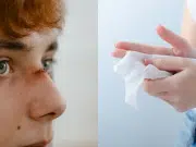 Invima alerta sobre el uso de toallas húmedas en la piel: advierten de riesgos por graves infecciones en tratamientos inadecuados con heridas