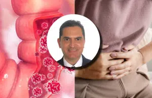 ‘Estamos viendo cada vez más casos’: experto advierte aumento de la EII en Colombia; síntomas como dolor abdominal no deben ignorarse