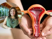 El tipo de cáncer que afecta sobre todo a las mujeres después de la menopausia: ‘el sangrado es un síntoma de alerta’