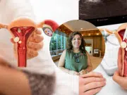 ‘Es el tumor más letal de los ginecológicos’: experta advierte por el cáncer de ovario y lo poco que se promueve su detección; estos son sus síntomas