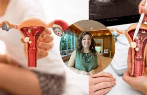 ‘Es el tumor más letal de los ginecológicos’: experta advierte por el cáncer de ovario y lo poco que se promueve su detección; estos son sus síntomas