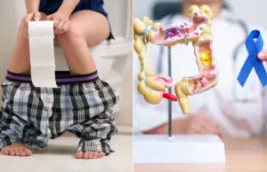 Cáncer de colon: así cambian las heces cuando algo no está bien y las señales que podrían alertar un problema grave a tiempo