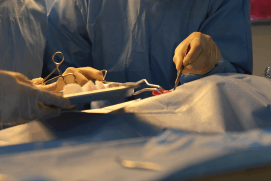 La historia de una cirugía inédita en Colombia que le salvó la vida a una niña de 13 años