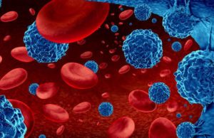 El cáncer que afecta principalmente a adultos mayores y crece en Colombia: a expertos les preocupa el diagnóstico tardío
