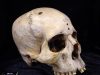 Las razones por las que el cráneo humano ha evolucionado en los últimos 100 años: no es por genética