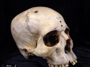 Las razones por las que el cráneo humano ha evolucionado en los últimos 100 años: no es por genética