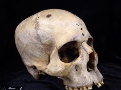 Las razones por las que el cráneo humano ha evolucionado en los últimos 100 años: no es por genética