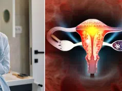 Estar hinchada siempre no es normal: el síntoma que podría ocultar un cáncer de ovario y que los oncólogos piden no normalizar