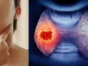 Hipotiroidismo e hipertiroidismo: las señales de alerta de la tiroides que toda mujer colombiana debe conocer