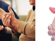 Las primeras señales de la artritis que las personas suelen pasar por alto y cómo comenzar a prevenir la enfermedad