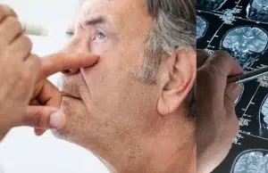 Los ojos podrían revelar inicios de Parkinson y Alzheimer: así avanzan los estudios