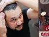 ¿Si utiliza gorra se puede quedar calvo? Expertos en dermatología responden a varios mitos sobre la alopecia