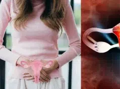 Médicos anuncian cambio en el nombre oficial del Síndrome de Ovario Poliquístico: la medida para proteger la salud de la población femenina