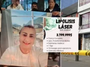 Caso de Yulixa Toloza: los consejos y los errores más comunes a la hora de someterse a un procedimiento estético