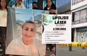 Caso de Yulixa Toloza: los consejos y los errores más comunes a la hora de someterse a un procedimiento estético
