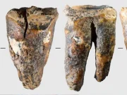 El sorprendente tratamiento dental de los neandertales: un diente de 59.000 años reescribe la historia de la medicina