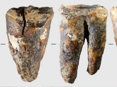 El sorprendente tratamiento dental de los neandertales: un diente de 59.000 años reescribe la historia de la medicina