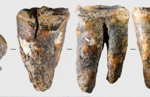 El sorprendente tratamiento dental de los neandertales: un diente de 59.000 años reescribe la historia de la medicina