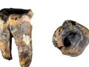 El misterio del primer odontólogo: hallan un diente Neandertal que revela cómo se trataban las caries hace 59.000 años