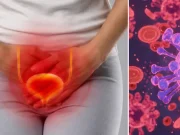 Infecciones urinarias recurrentes: este es el cambio de enfoque en urología para reducir el uso de antibióticos con dos nuevas terapias de prevención