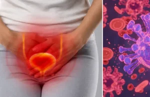 Infecciones urinarias recurrentes: este es el cambio de enfoque en urología para reducir el uso de antibióticos con dos nuevas terapias de prevención