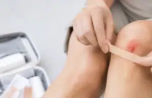 ¿Qué hacer ante cortes, raspones y hemorragias para evitar infecciones y complicaciones? Especialistas responden