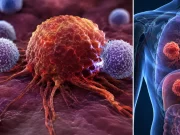 Científicos descubren el error que haría que el cáncer acelere y sea más difícil de curar: estas células pequeñas se asocian con peor pronóstico