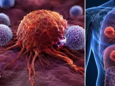 Científicos descubren el error que haría que el cáncer acelere y sea más difícil de curar: estas células pequeñas se asocian con peor pronóstico