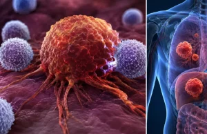 Científicos descubren el error que haría que el cáncer acelere y sea más difícil de curar: estas células pequeñas se asocian con peor pronóstico