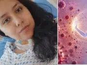 La joven de ‘acero’ que, con solo 29 años, padece seis enfermedades crónicas y no se rinde: ‘Que nos veamos normales no quiere decir que estemos bien’