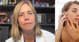La gastroenteróloga Juliana Suárez advierte, sin tapujos, sobre las enfermedades en la piel que tienen relación con el intestino