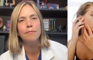 La gastroenteróloga Juliana Suárez advierte, sin tapujos, sobre las enfermedades en la piel que tienen relación con el intestino