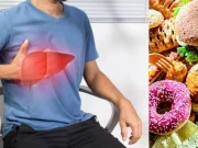 Hígado graso: alimentos de consumo diario que pueden acelerar su daño y riesgos para la salud hepática