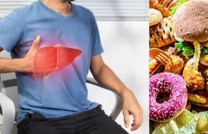 Hígado graso: alimentos de consumo diario que pueden acelerar su daño y riesgos para la salud hepática