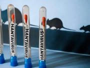 En Colombia no hay casos confirmados de hantavirus