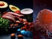 La ‘dieta anticáncer’ no existe, pero sí está claro que la nutrición tiene mucho que ver con el cáncer, según un experto