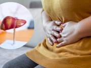 Más allá del alcohol: el experto que revela los 9 hábitos cotidianos que pueden dañar su hígado sin que lo note