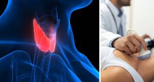 ¿Cuáles son los primeros síntomas del cáncer de tiroides que han padecido Arelys Henao y Andrea Serna?